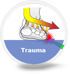 trauma-foot